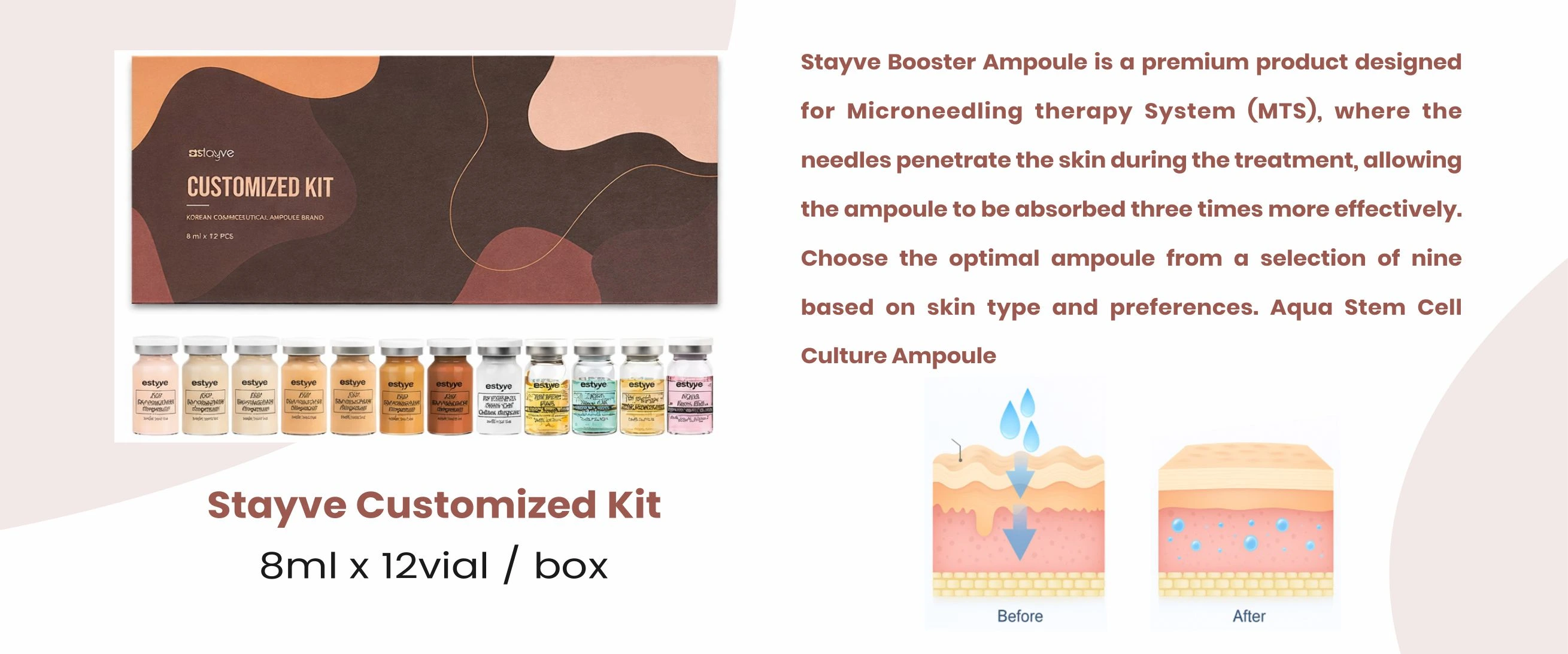 Modular Switches Project