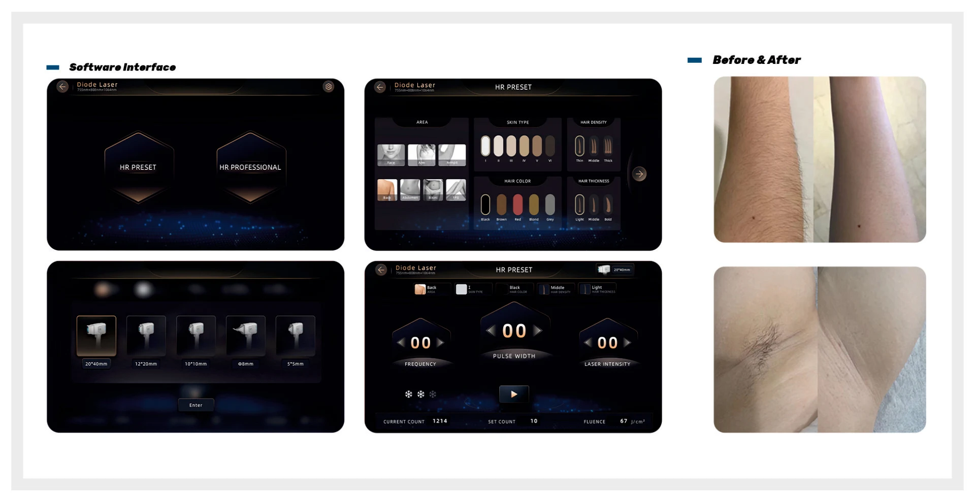 Modular Switches Project