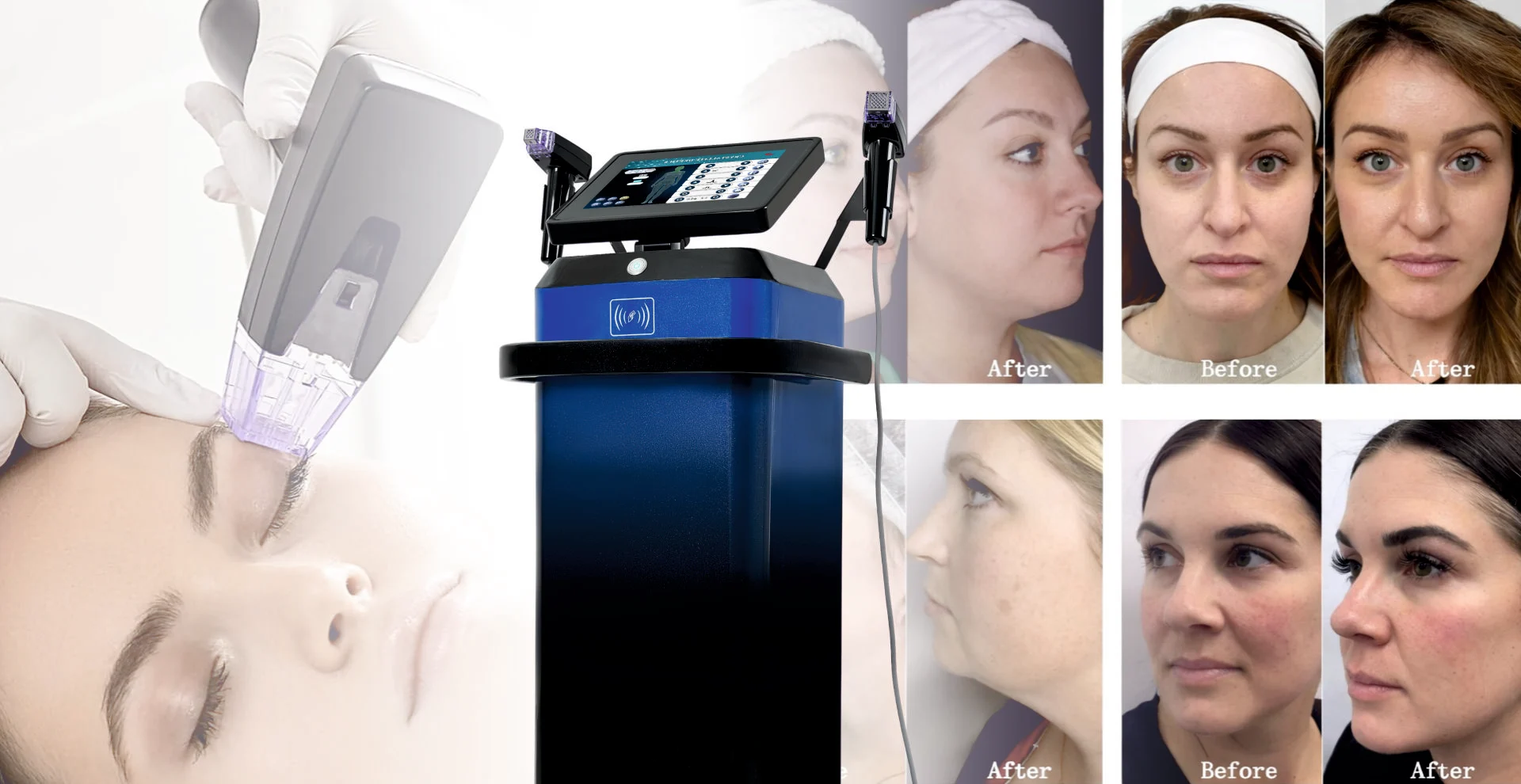 Modular Switches Project