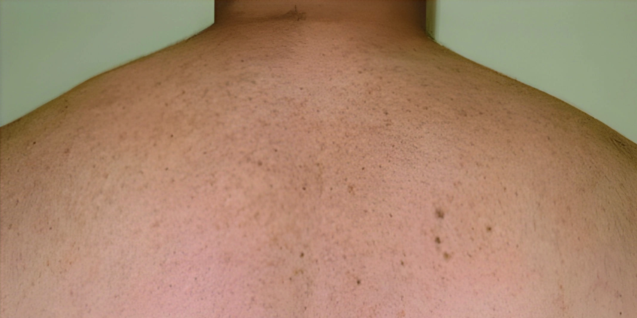 After Image