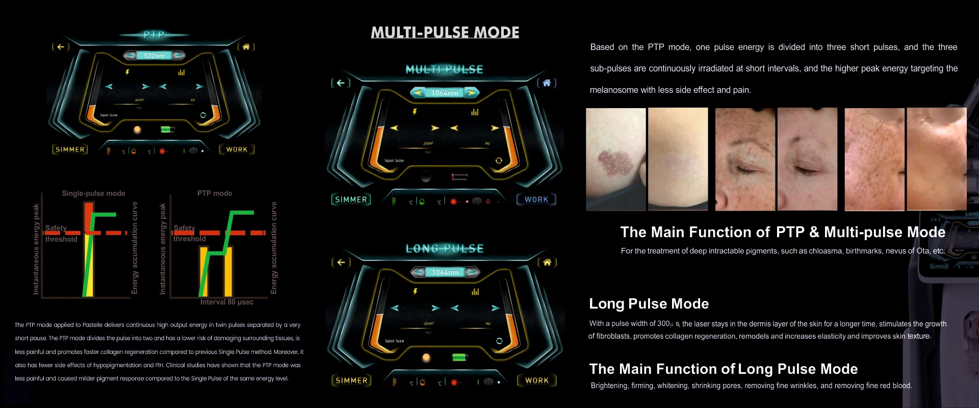 Sockets & Plug Tops Project
