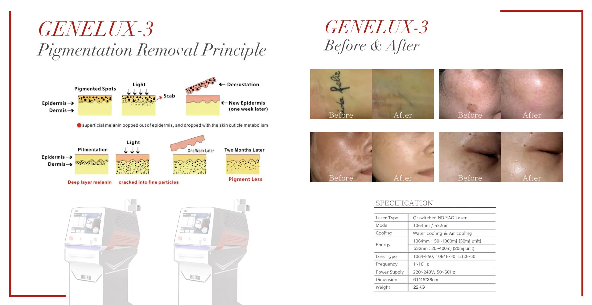 Modular Switches Project