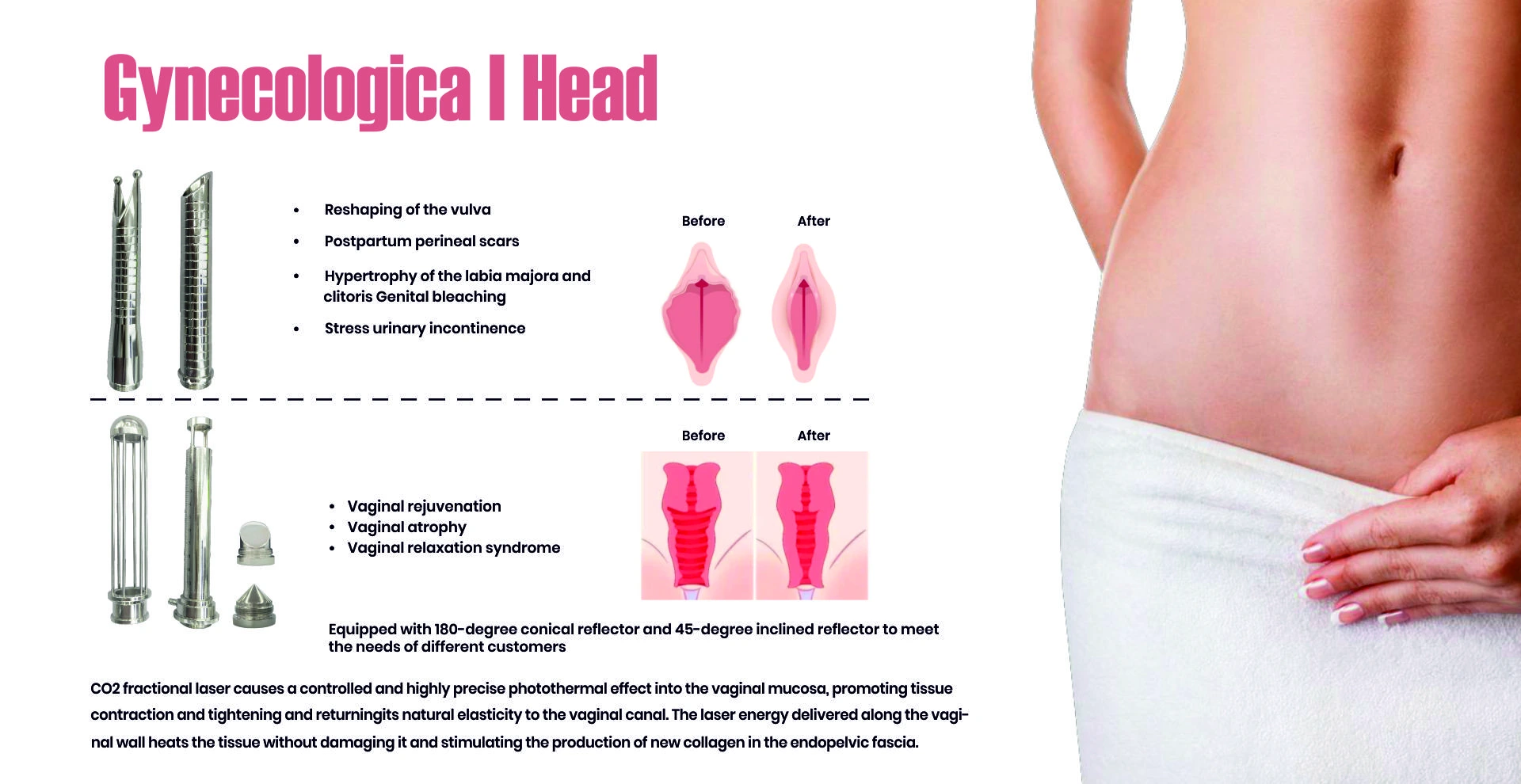 Modular Switches Project