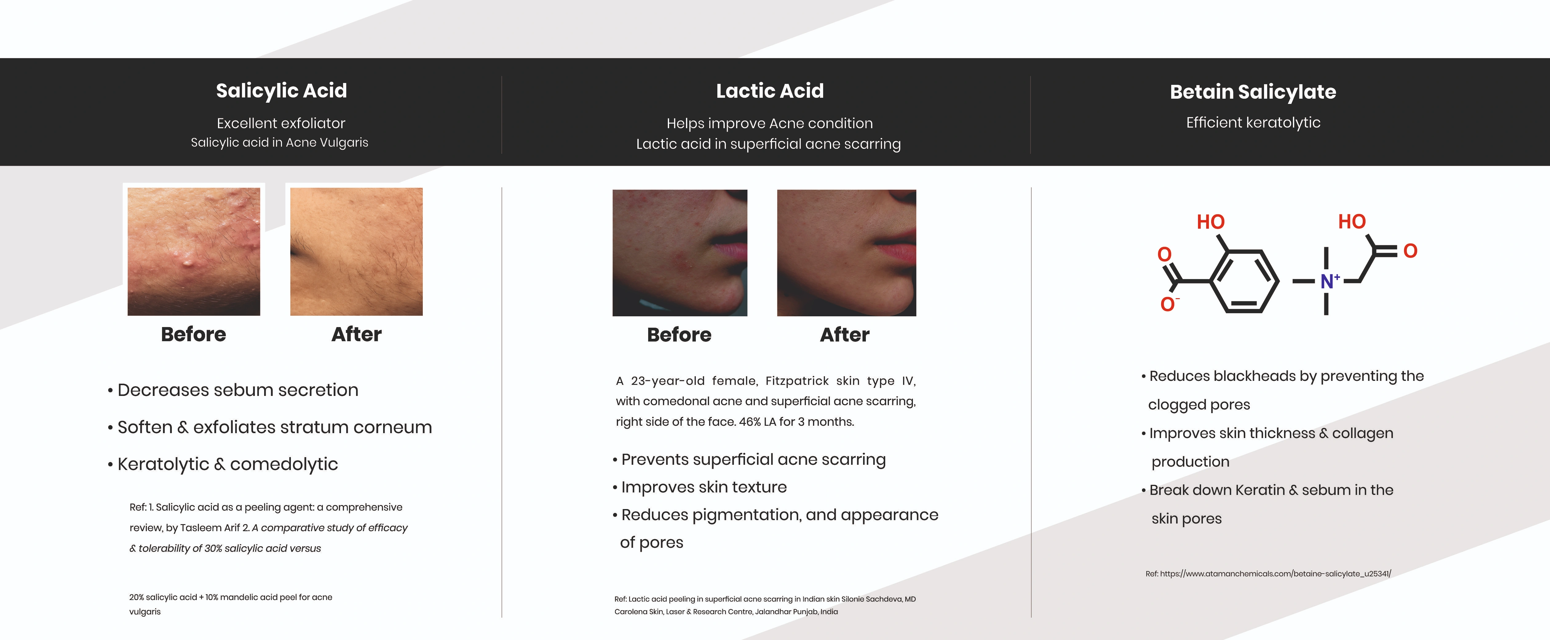 Modular Switches Project